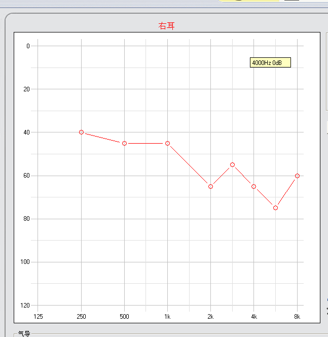 QQͼ20151101170717.png