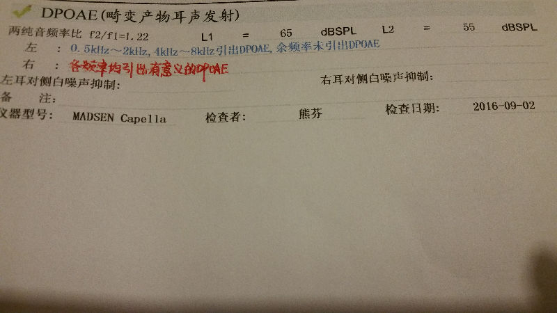 20160804_224038.jpg