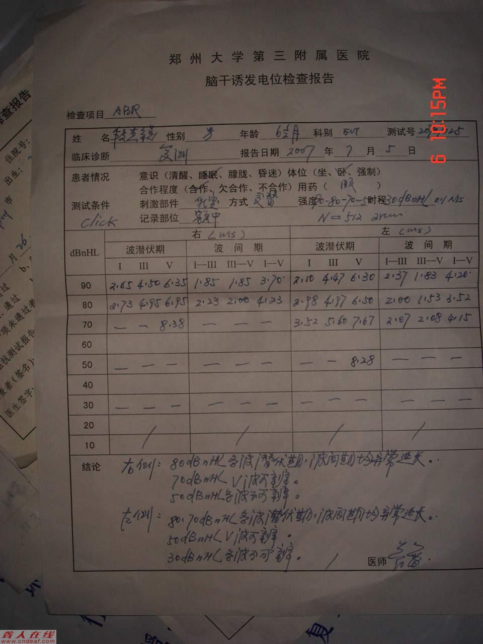 DSC00764.JPG