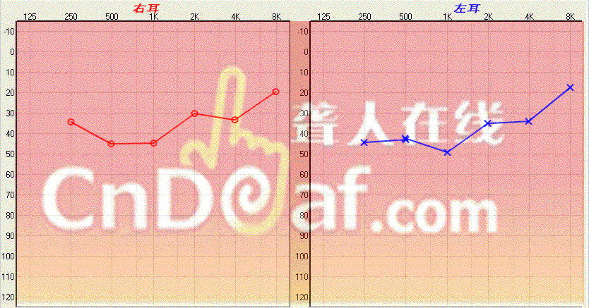 ͼ.GIF