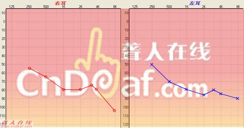 deaf.jpg