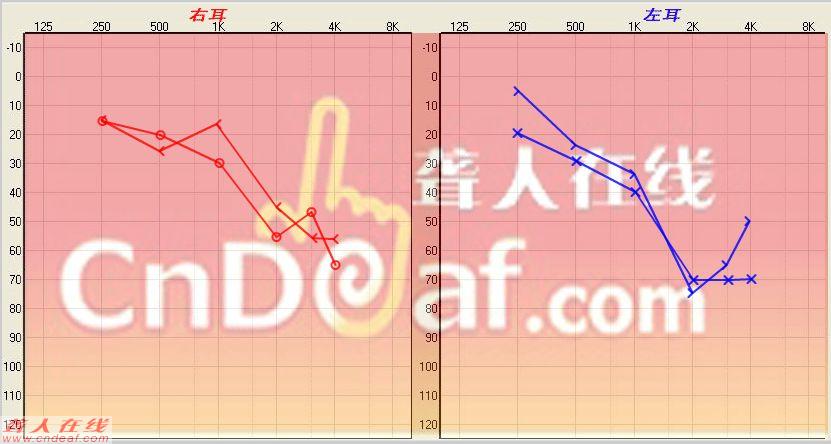 β