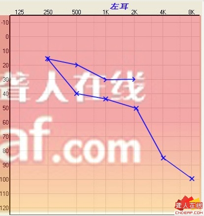 δ5.jpg