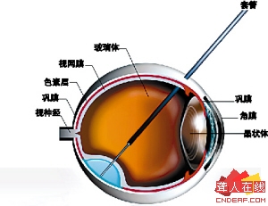 res03_attpic_brief[1].jpg