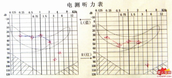 㲹