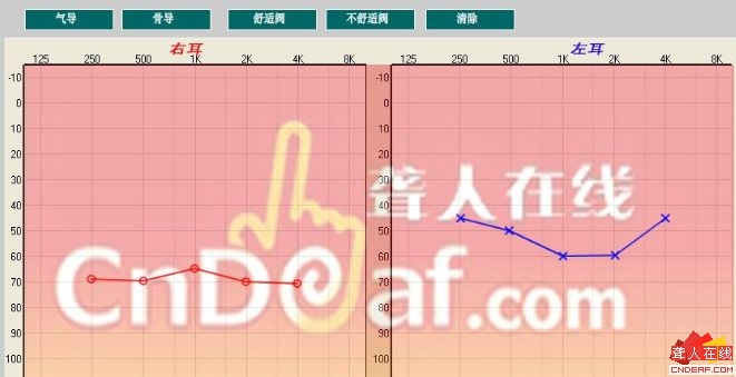 δ2.jpg