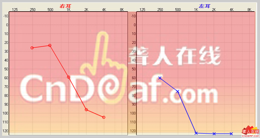 .PNG