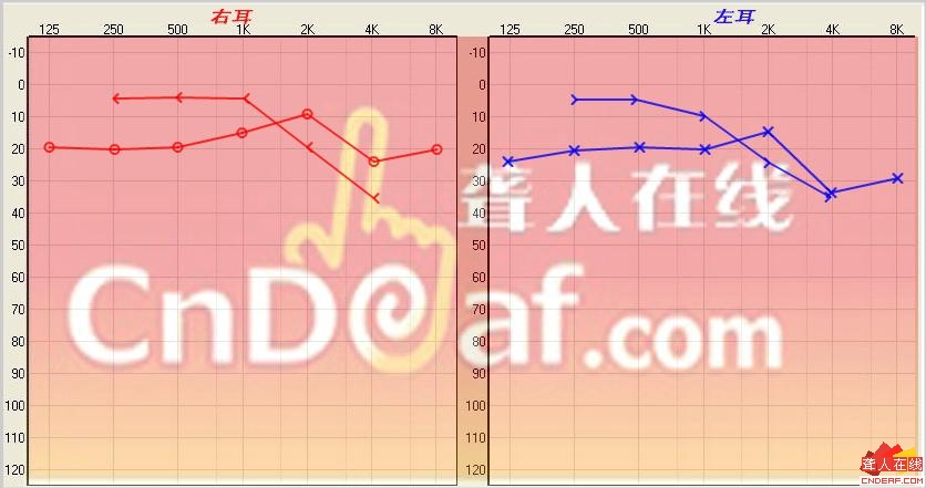 ε