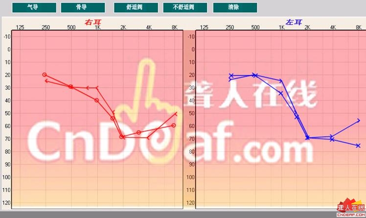 δ.jpg