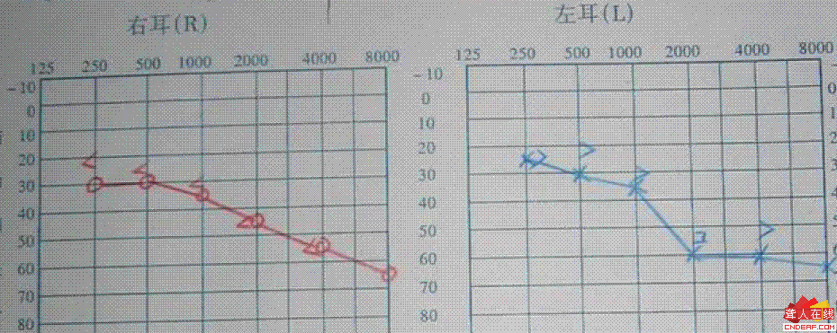 hearing.GIF