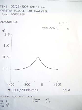 P1010064.JPG