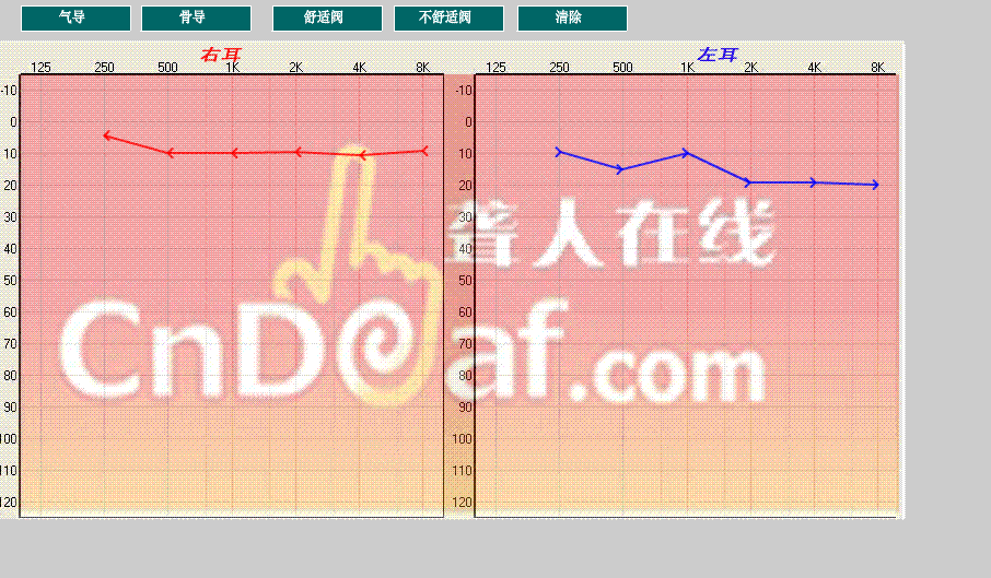 ǵ.GIF