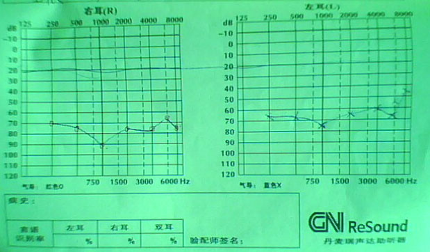 δ-1.jpg