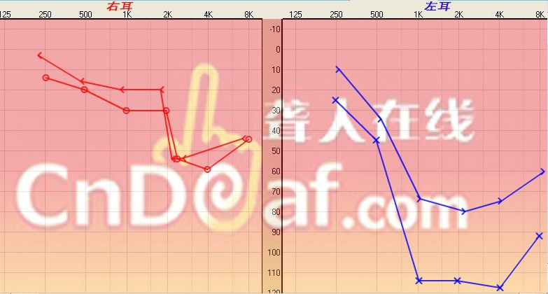 Ժ