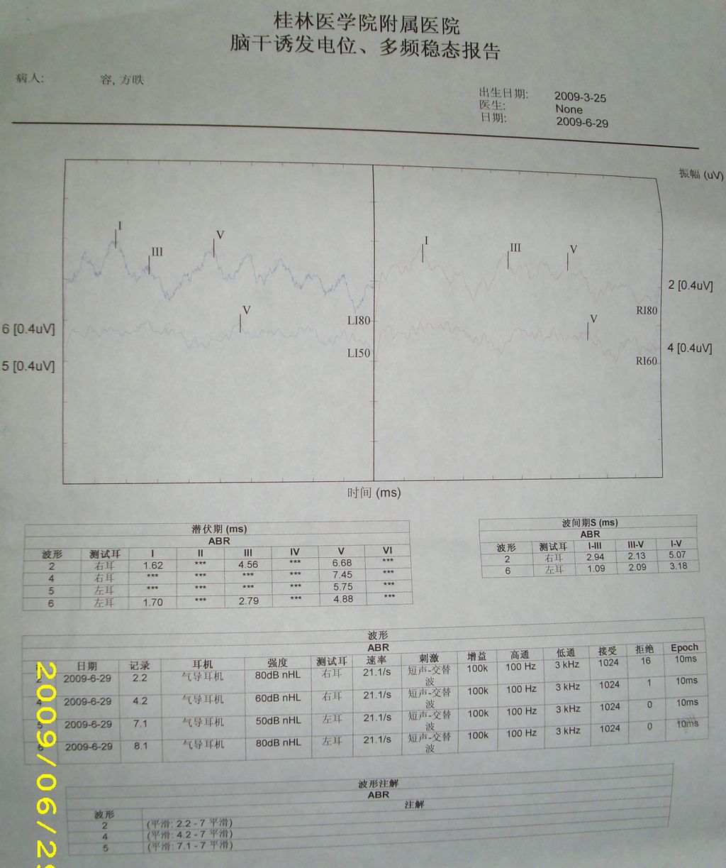 ABR