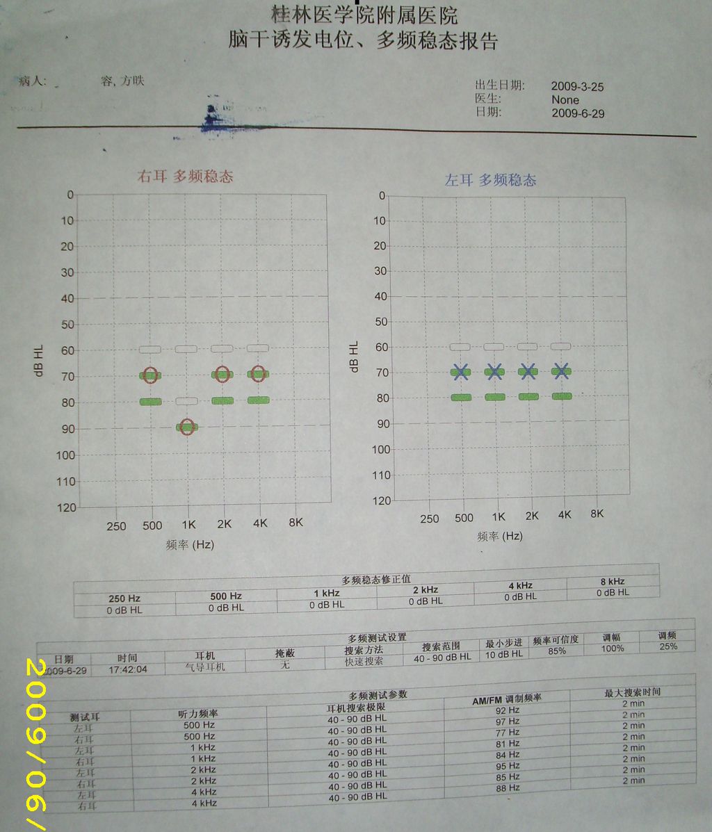 ASSR
