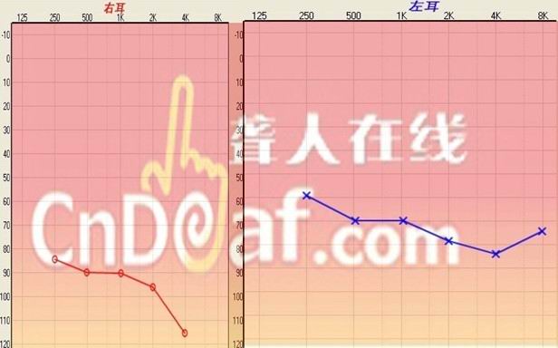 .jpg