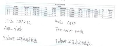ABR