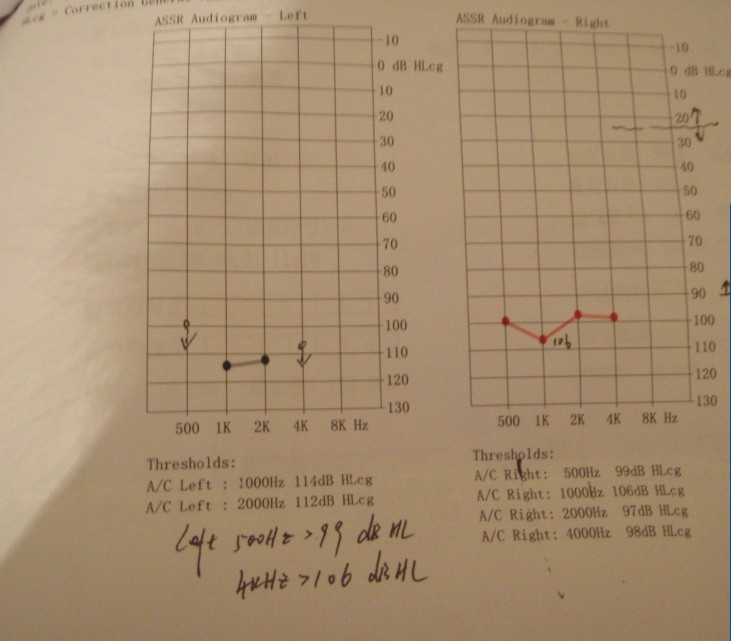 OR%[_)2@LT`6S]~2Z)STZBC.jpg