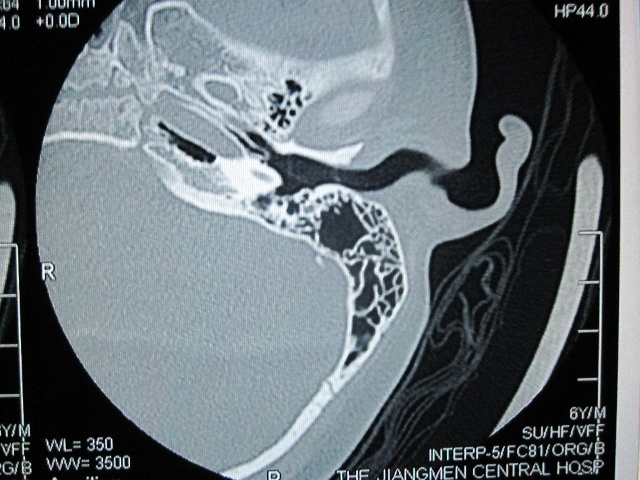124ee14fbc5g213.jpg