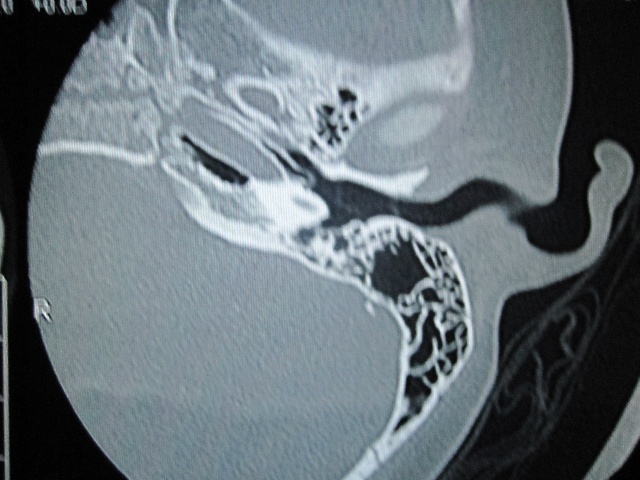 124ee0fb99ag215.jpg