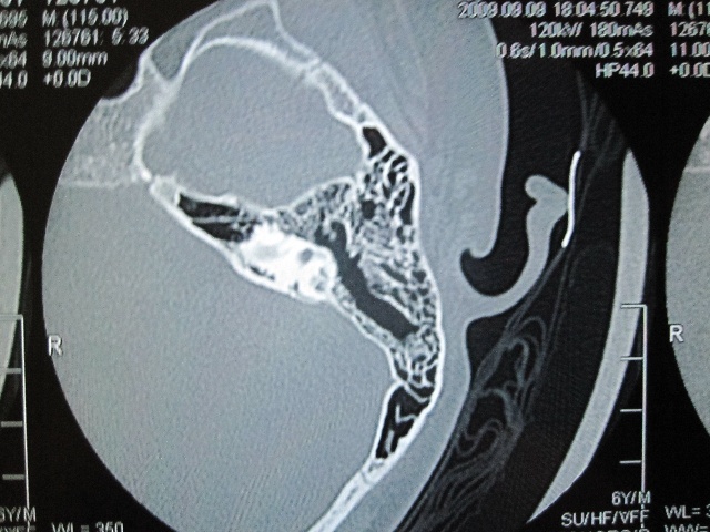 124ee10de19g215.jpg
