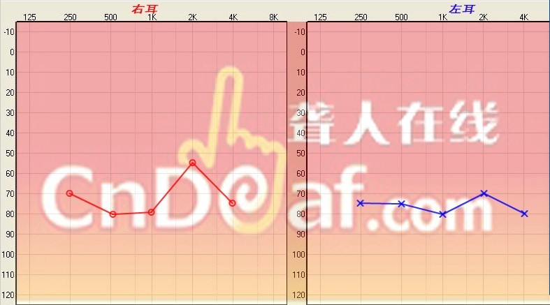δ.jpg