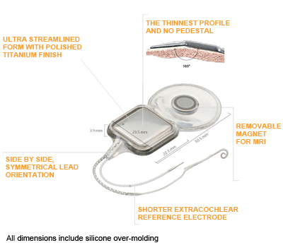 thinnest-cochlear-implant-illustration.png