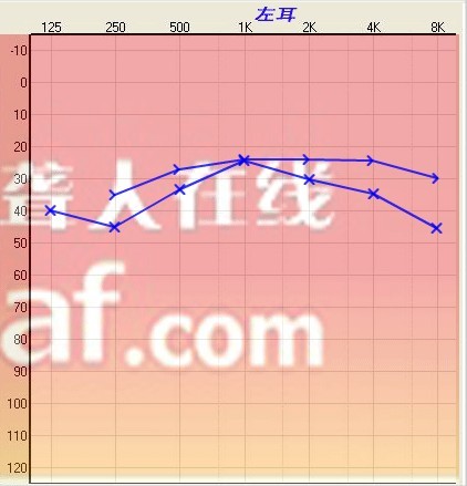 δ1.jpg