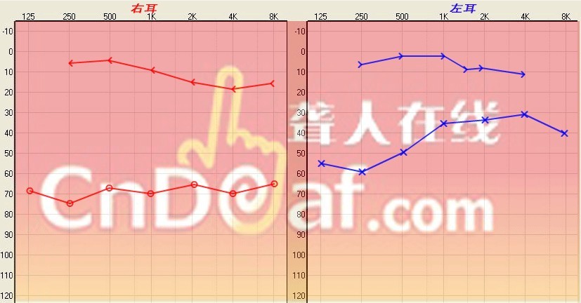 δ.jpg