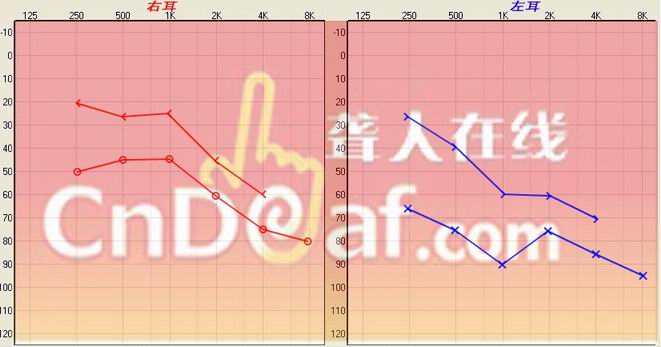 IKTP@DA3`LPD~O]3_P5XPW9.jpg