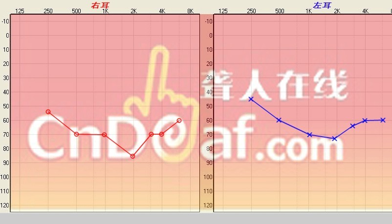 δ.jpg