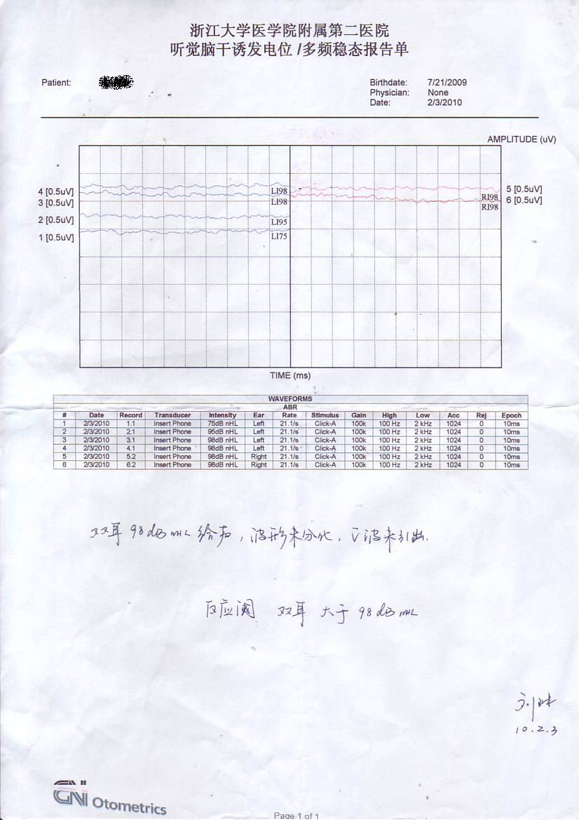 ABR