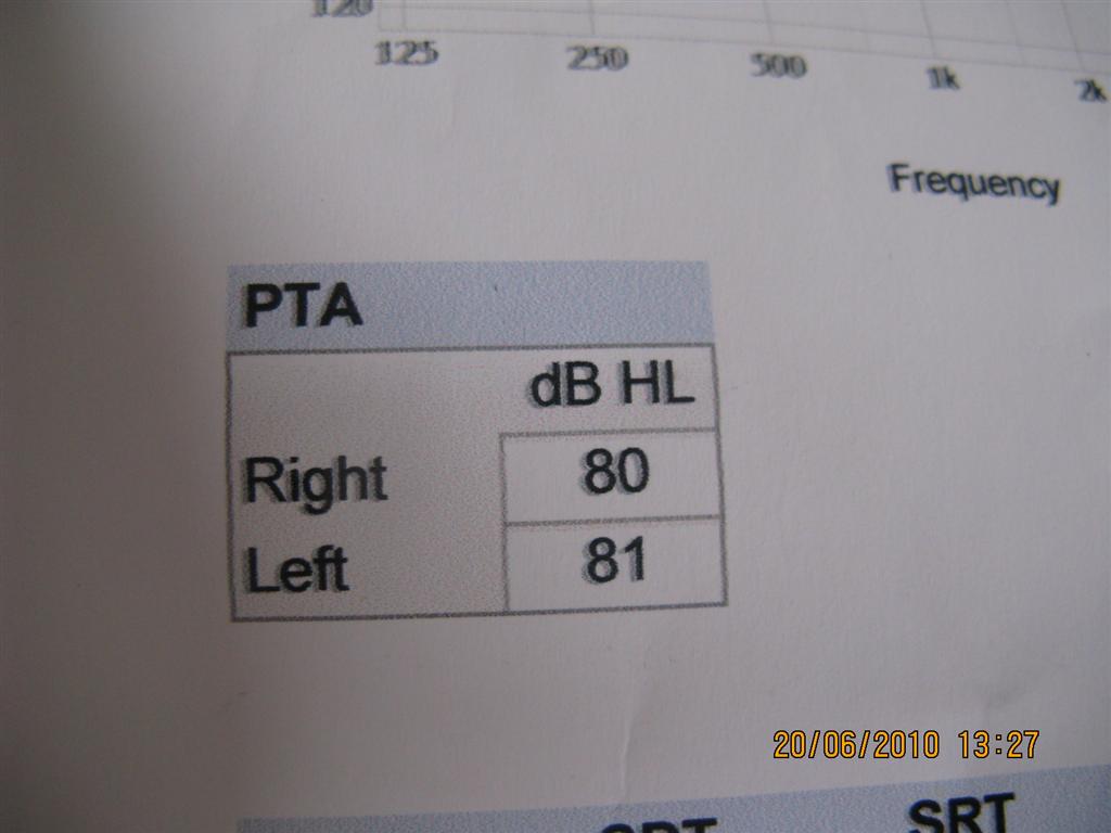 IMG_0057 (Large).JPG