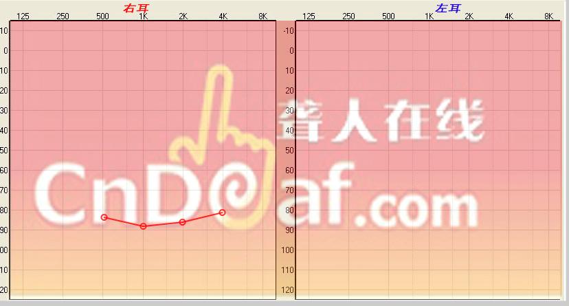 301ҽԺ106µASSR.