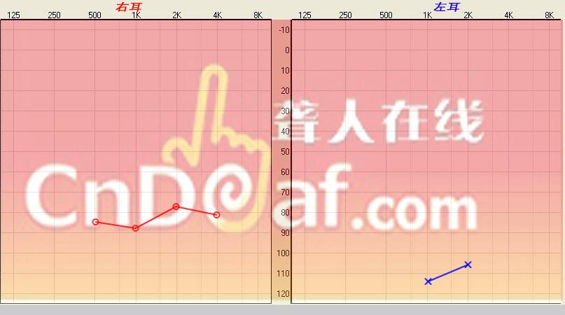 301ҽԺ097µASSR.