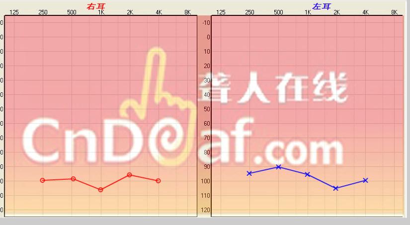 6µӾǿ