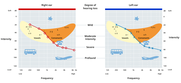 05_02_01_05_audiogram-s.gif