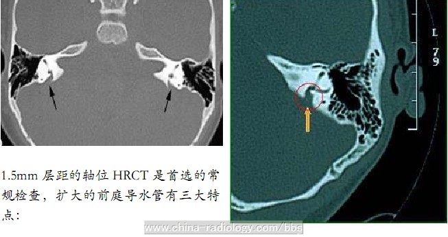 CT-ǰͥˮ.jpg