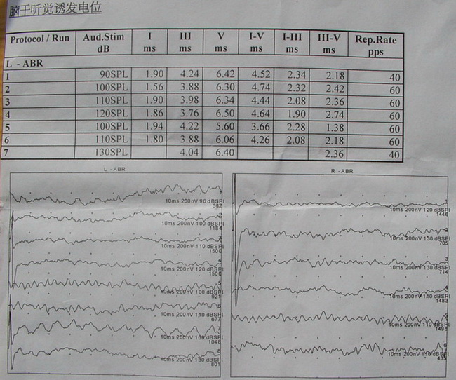 IMGP3860.jpg