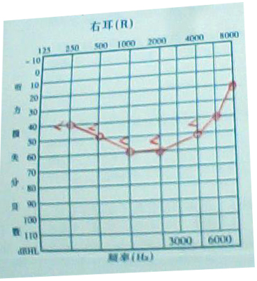δ-1.jpg