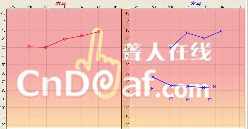 δ.jpg