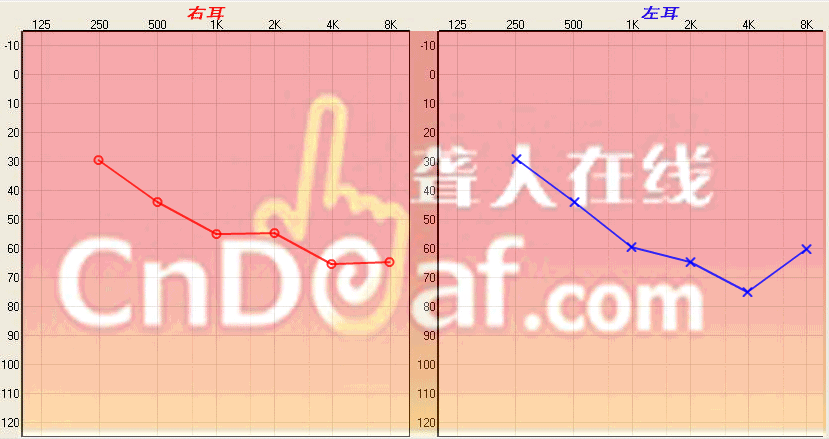 ͼ 1.gif