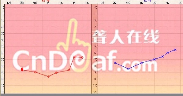 δ3.jpg