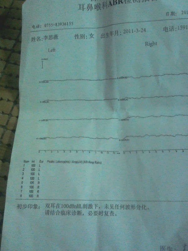 ABR.jpg