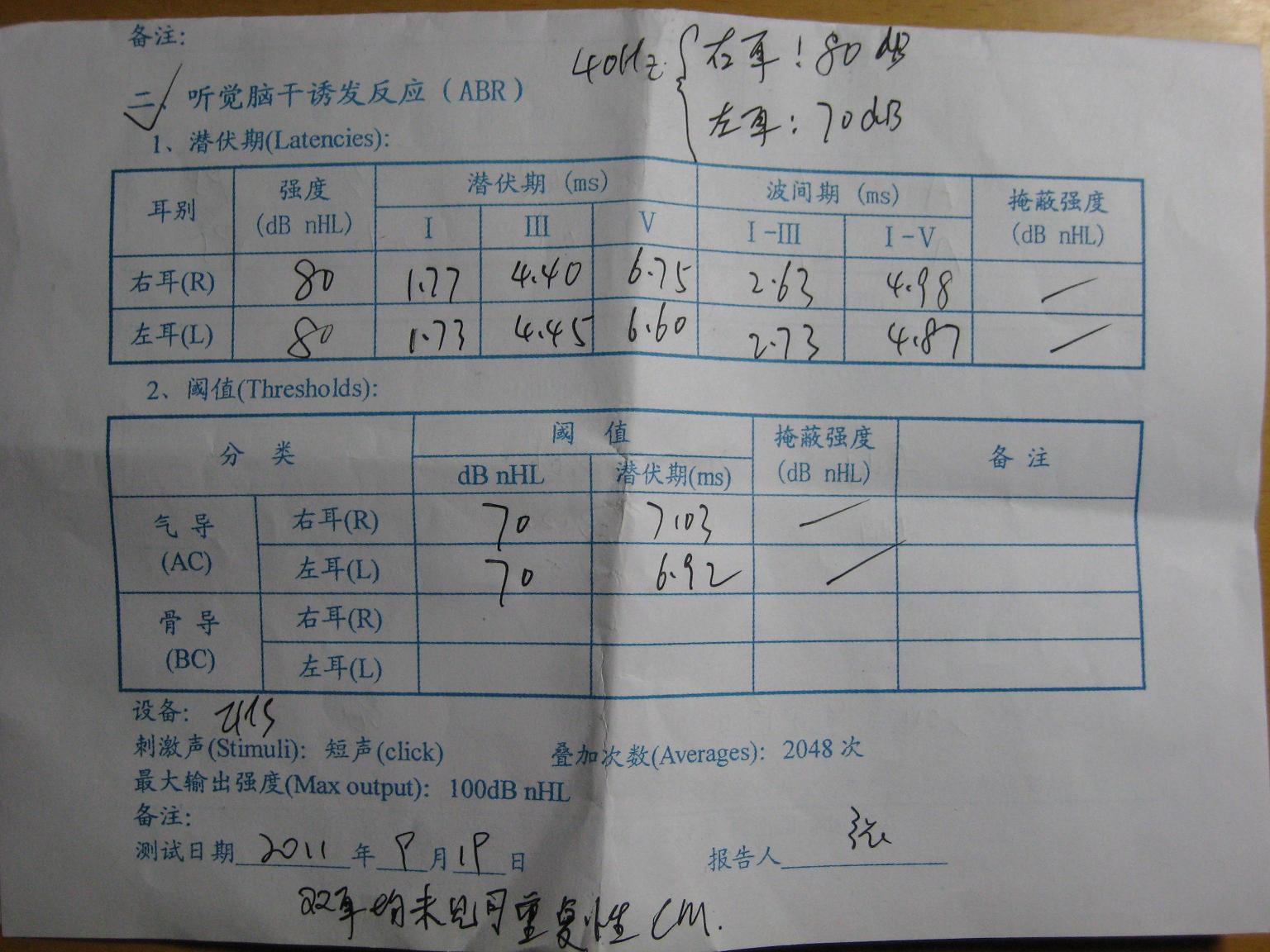 ABR