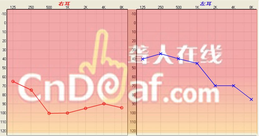 .png