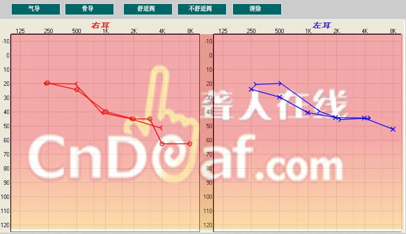 Z0NZ~SK9[F`K{TA7D[1[__0.jpg