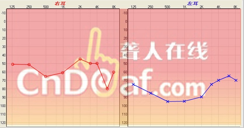 δ.jpg