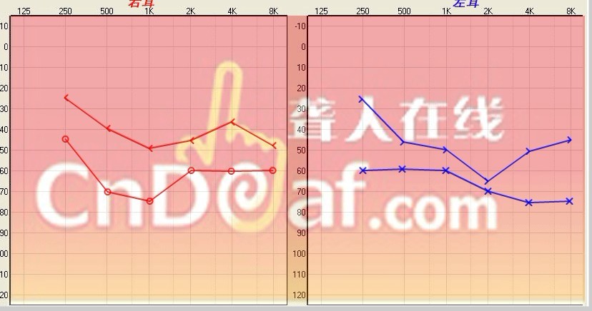 δ.jpg
